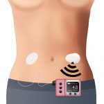 CGM-Systeme als Zeichnung