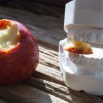 Diabetes und Parodontitis