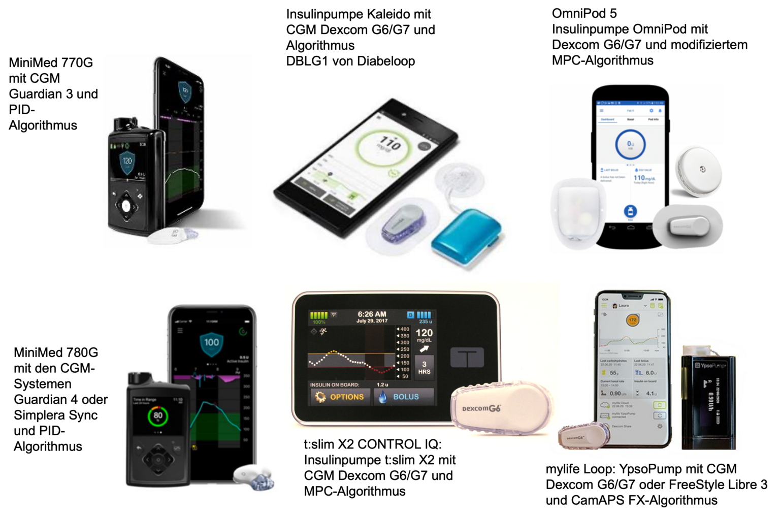 Systeme zur Automatisierten Insulinabgabe (AID-Systeme) - diabetes-news ...